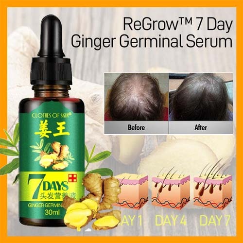 Fast Hair Growth Ginger Oil – Natural Hair Loss Care