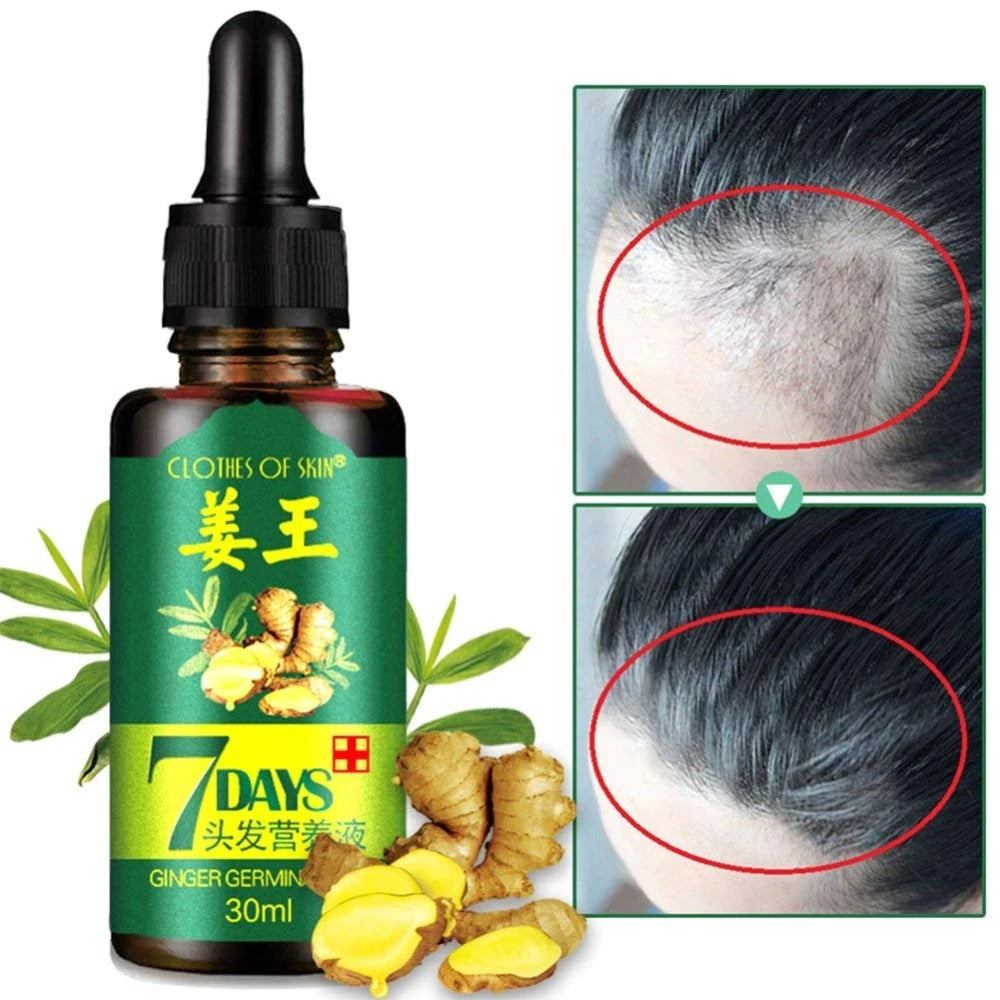Fast Hair Growth Ginger Oil – Natural Hair Loss Care